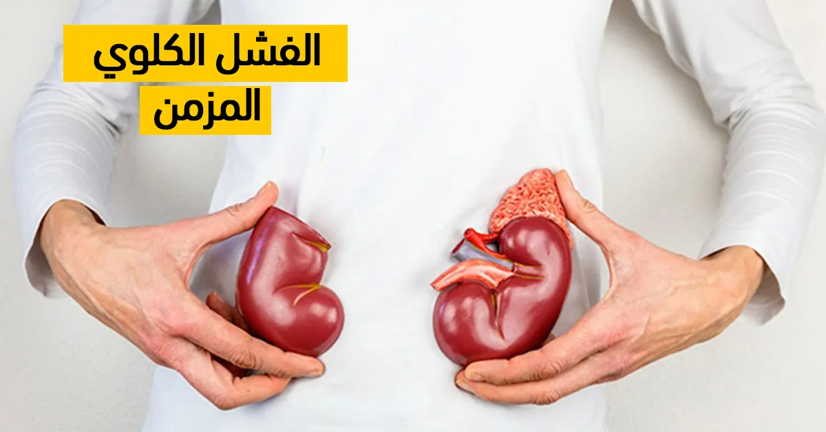 الفشل الكلوي المزمن